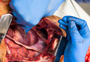 PERT Kurs Notfallthorakotomie